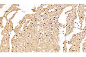 Detection of IL6 in Rat Cardiac Muscle Tissue using Polyclonal Antibody to Interleukin 6 (IL6) (IL-6 anticorps  (AA 21-211))