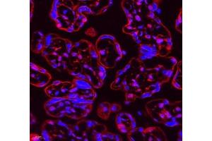 Immunofluorescence of paraffin embedded human placenta using Neil1 (ABIN7073820) at dilution of 1: 300 (400x lens) (NEIL1 anticorps)