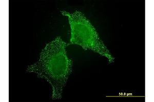 Immunofluorescence of monoclonal antibody to CIB1 on HeLa cell.
