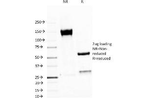 SDS-PAGE Analysis Purified MUC-1 / EMA Mouse Monoclonal Antibody (MUC1/520).