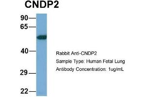 Host: Rabbit  Target Name: CNDP2  Sample Tissue: Human Fetal Lung  Antibody Dilution: 1. (CNDP2 anticorps  (Middle Region))