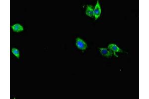 Immunofluorescent analysis of Hela cells using ABIN7167229 at dilution of 1:100 and Alexa Fluor 488-congugated AffiniPure Goat Anti-Rabbit IgG(H+L) (RAB12 anticorps  (AA 98-241))