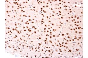 IHC-P Image beta-TrCP antibody [N1C1] detects beta-TrCP protein at nucleus on rat fore brain by immunohistochemical analysis.