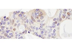 anti-Ubiquitin Specific Peptidase 28 (USP28) (AA 500-550) antibody