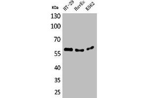 Western Blot analysis of HT29 HuvEc K562 cells using CYP11B1/2 Polyclonal Antibody (CYP11B1 anticorps  (N-Term))