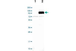 Western blot analysis of Lane 1: Negative control (vector only transfected HEK293T lysate), Lane 2: Over-expression Lysate (Co-expressed with a C-terminal myc-DDK tag (~3. (DLG3 anticorps)