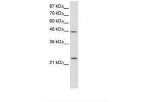 anti-Chromobox Homolog 6 (CBX6) (N-Term) antibody