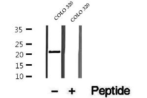 Western blot analysis of extracts of COLO 320 cells, using OBFC2A antibody. (OBFC2A anticorps  (Internal Region))