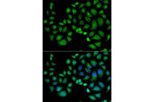 Immunofluorescence analysis of HeLa cell using CLIC1 antibody. (CLIC1 anticorps)