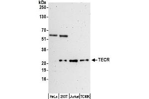 anti-Trans-2,3-Enoyl-CoA Reductase (TECR) (AA 200-250) antibody