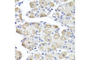 Immunohistochemistry of paraffin-embedded human stomach using OTC antibody.