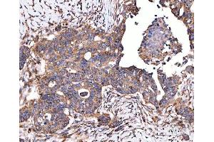 IHC analysis of SERAC1 using anti-SERAC1 antibody (ABIN7602709). (SERAC1 anticorps  (AA 97-623))