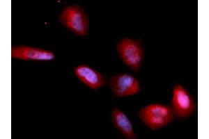 Immunofluorescence (IF) image for anti-CD33 (CD33) (AA 18-259) antibody (PE) (ABIN5567445) (CD33 anticorps  (AA 18-259) (PE))