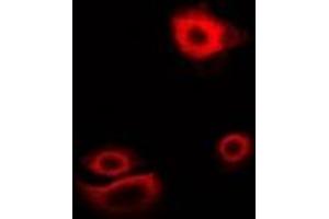 Immunofluorescent analysis of Myotilin staining in U2OS cells. (Myotilin anticorps)