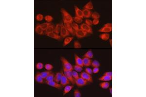 Immunohistochemistry of paraffin-embedded human tonsil using ARMET/ARP/MANF Rabbit pAb (ABIN6129561, ABIN6143461, ABIN6143463 and ABIN6222775) at dilution of 1:50 (40x lens).