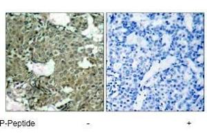 Image no. 3 for anti-Mitogen-Activated Protein Kinase Kinase 1 (MAP2K1) (pSer221), (pSer222) antibody (ABIN196889) (MEK1 anticorps  (pSer221, pSer222))
