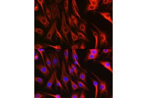 Immunofluorescence analysis of C6 cells using Alpha-tubulin (ubiquitous) chain antibody (ABIN7271033) at dilution of 1:100. (TUBA1B anticorps  (AA 1-451))