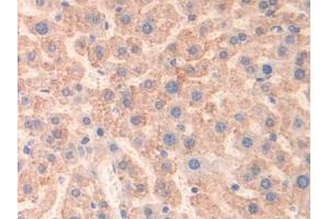 Detection of MAOB in Mouse Liver Tissue using Polyclonal Antibody to Monoamine Oxidase B (MAOB)