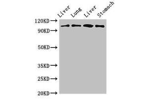 Western Blot Positive WB detected in: Rat liver tissue, Rat lung tissue, Mouse liver tissue, Mouse stomach tissue All lanes: MAP3K13 antibody at 3 μg/mL Secondary Goat polyclonal to rabbit IgG at 1/50000 dilution Predicted band size: 109, 18, 93, 86, 15 kDa Observed band size: 109 kDa (MAP3K13 anticorps  (AA 506-835))