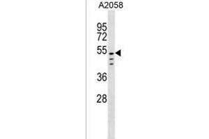 CLEC18C Antibody (C-term) (ABIN1537091 and ABIN2850339) western blot analysis in  cell line lysates (35 μg/lane). (CLEC18C anticorps  (C-Term))