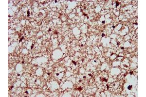 IHC image of ABIN7162805 diluted at 1:300 and staining in paraffin-embedded human brain tissue performed on a Leica BondTM system.