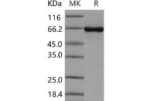Western Blotting (WB) image for Casein Kinase 2 alpha 1 (CSNK2A1) (Active) protein (GST tag,His tag) (ABIN7320004) (CSNK2A1/CK II alpha Protein (GST tag,His tag))