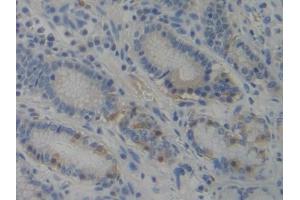 anti-phosphoinositide-3-Kinase Adaptor Protein 1 (PIK3AP1) (AA 489-730) antibody