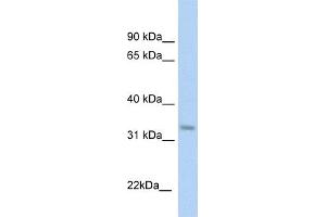 WB Suggested Anti-KHK Antibody  Titration: 1 ug/ml Positive Control: Fetal liver cell lysate (Ketohexokinase anticorps  (C-Term))