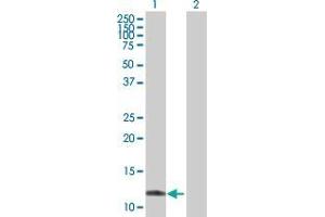 Western Blot analysis of TTLL3 expression in transfected 293T cell line by TTLL3 MaxPab polyclonal antibody. (TTLL3 anticorps  (AA 1-101))