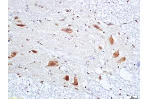 Formalin-fixed and paraffin embedded rat spinal cord labeled with Anti-PMP22 Polyclonal Antibody, Unconjugated  at 1:200 followed by conjugation to the secondary antibody and DAB staining (PMP22 anticorps  (AA 101-160))