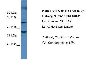 WB Suggested Anti-CYP11B1  Antibody Titration: 0.
