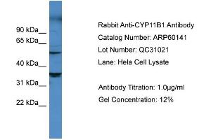 WB Suggested Anti-CYP11B1  Antibody Titration: 0. (CYP11B1 anticorps  (Middle Region))