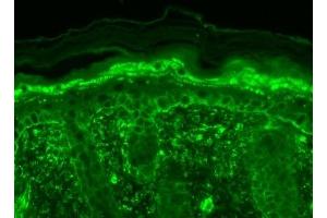 Immunohistochemistry analysis using Mouse Anti-TrpV3 Monoclonal Antibody, Clone S15-39 (ABIN863127).