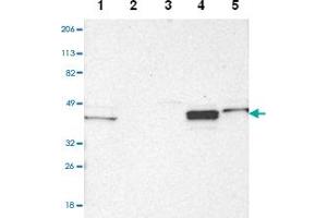Western blot analysis of Lane 1: Human cell line RT-4, Lane 2: Human cell line U-251MG sp, Lane 3: Human cell line A-431, Lane 4: Human liver tissue, Lane5: Human tonsil tissue with NDRG2 polyclonal antibody  at 1:2500-1:5000 dilution. (NDRG2 anticorps)