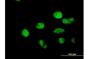 Immunofluorescence of purified MaxPab antibody to MSH2 on HeLa cell. (MSH2 anticorps  (AA 1-934))