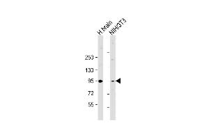 All lanes : Anti-PRKD2 Antibody (Center) at 1:2000 dilution Lane 1: human brain lysate Lane 2: NIH/3T3 whole cell lysate Lysates/proteins at 20 μg per lane. (PKD2 anticorps  (AA 556-590))
