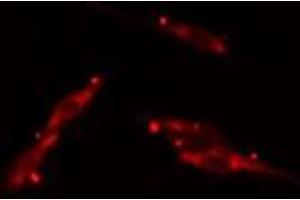 ABIN6275717 staining  HepG2 cells by IF/ICC. (TAZ anticorps  (Internal Region))