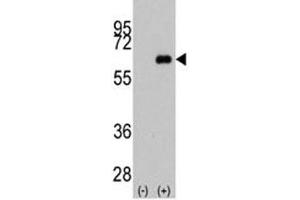 Western blot analysis of anti-c-Myc antibody and 293 cell lysate (2 ug/lane) either nontransfected (Lane 1) or transiently transfected with the MYC gene (2).