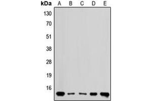 Western blot analysis of RPL36 expression in MDAMB435 (A), HEK293 (B), Raw264. (RPL36 anticorps  (Center))