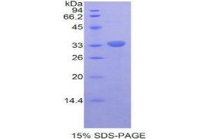 SDS-PAGE analysis of Mouse RELB Protein.