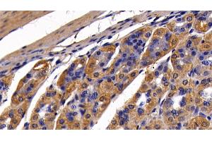 Detection of MAP2K6 in Mouse Stomach Tissue using Polyclonal Antibody to Mitogen Activated Protein Kinase Kinase 6 (MAP2K6)