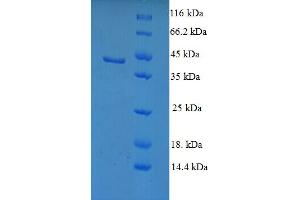 SDS-PAGE (SDS) image for Sterol Carrier Protein 2 (SCP2) (AA 1-143) protein (GST tag) (ABIN5710318) (SCP2 Protein (AA 1-143) (GST tag))