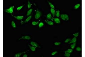 Immunofluorescence staining of Hela cells with ABIN7150414 at 1:66, counter-stained with DAPI.