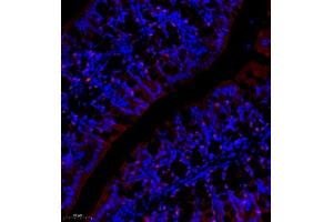 Immunofluorescence of paraffin embedded mouse colon using NCK (ABIN7074783) at dilution of 1:1000 (250x lens) (NCK2 anticorps)