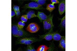 Immunofluorescence (IF) image for anti-BCL2-Like 1 (BCL2L1) (pSer62) antibody (ABIN1870015) (BCL2L1 anticorps  (pSer62))