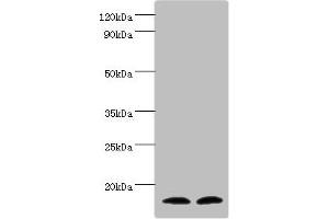 Western blot All lanes: Protachykinin-1 antibody at 6 μg/mL Lane 1: Mouse liver tissue Lane 2: 293T whole cell lysate Secondary Goat polyclonal to rabbit IgG at 1/10000 dilution Predicted band size: 16, 14, 12 kDa Observed band size: 16 kDa (TAC1 anticorps  (AA 1-129))