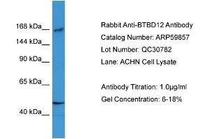 WB Suggested Anti-BTBD12  Antibody Titration: 0. (BTBD12 anticorps  (N-Term))