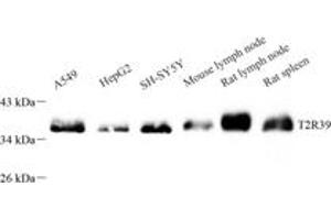 Western blot analysis of TAS2R39 (ABIN7075834) at dilution of 1: 600 (TAS2R39 anticorps)