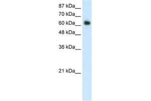 Western Blotting (WB) image for anti-Forkhead Box G1 (FOXG1) antibody (ABIN2461750) (FOXG1 anticorps)
