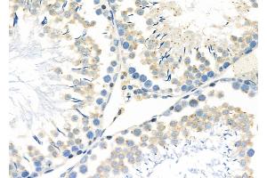 ABIN6257182 and ABIN6273598 at 1/100 staining Rat testis tissue by IHC-P. (FN3K anticorps  (Internal Region))
